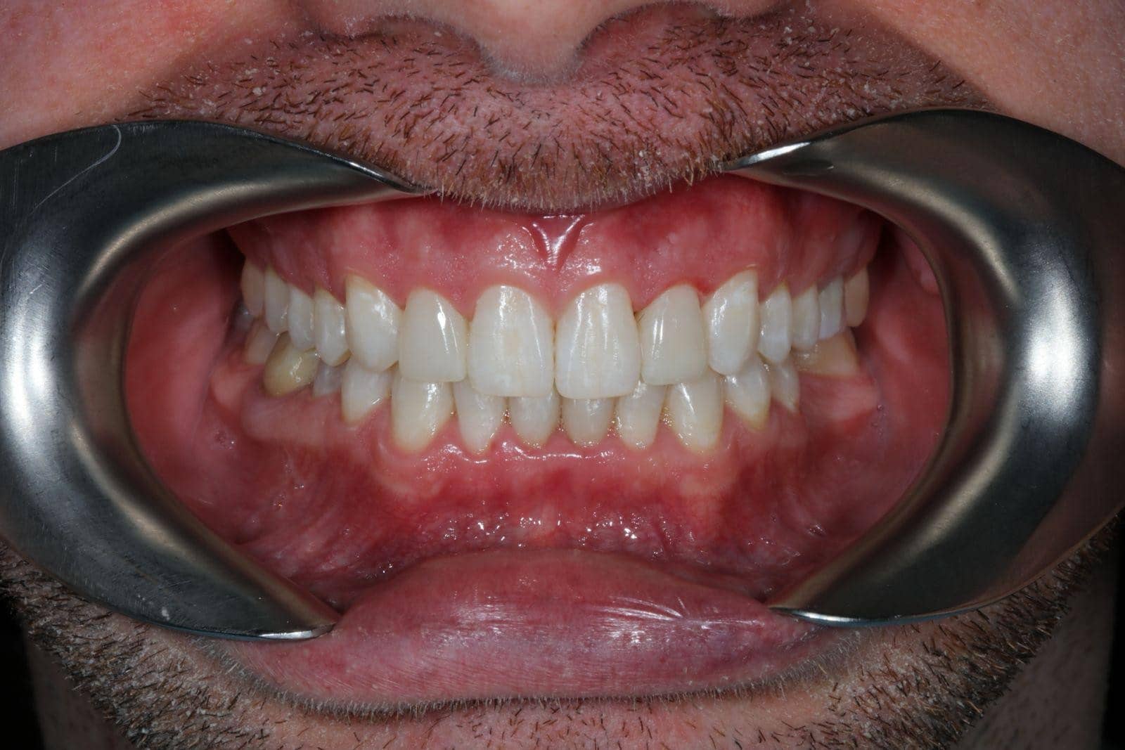 Cosmetic makeover case 1 after