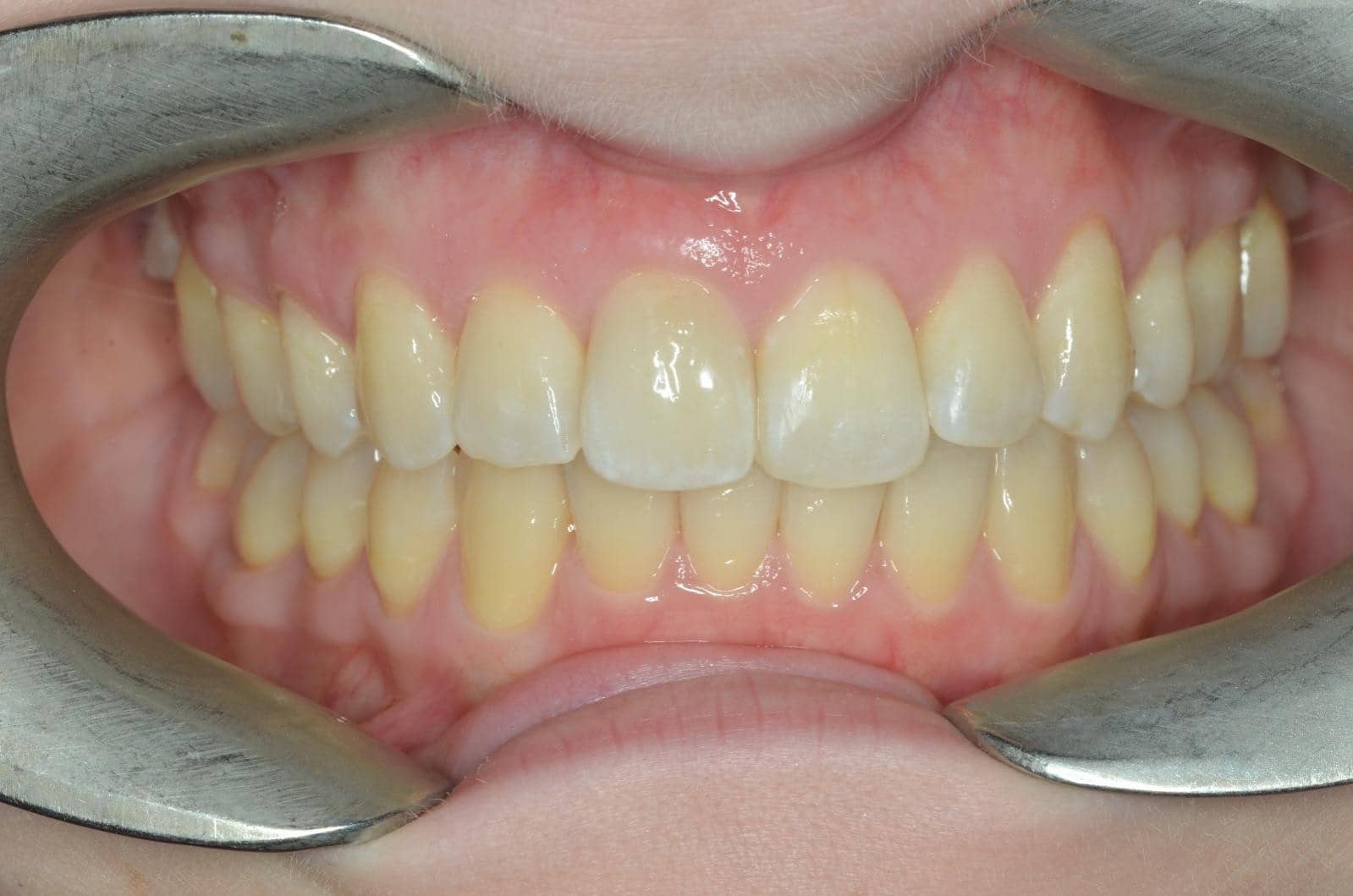 Cosmetic makeover case 2 after