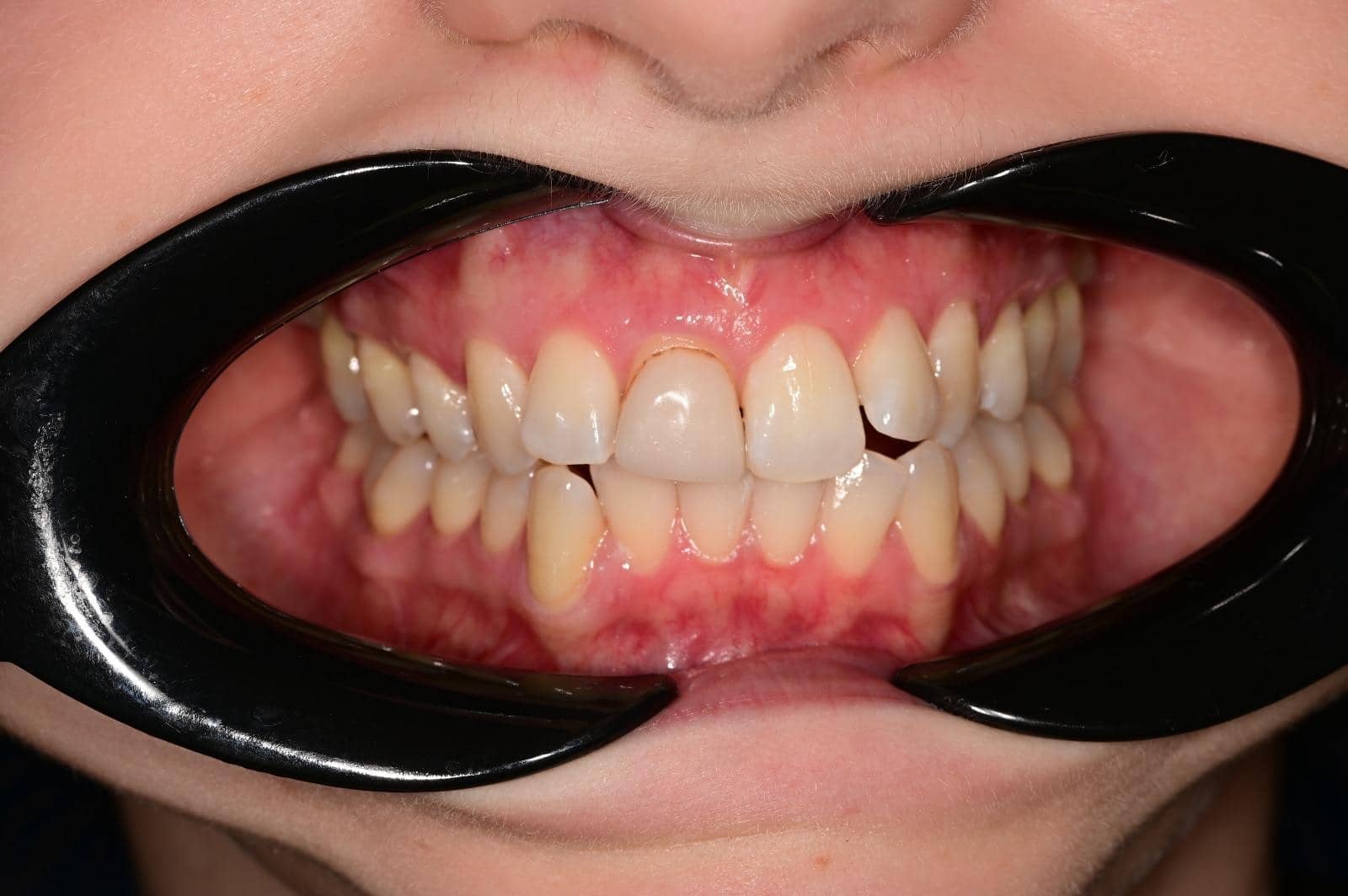 Cosmetic makeover case 2 before