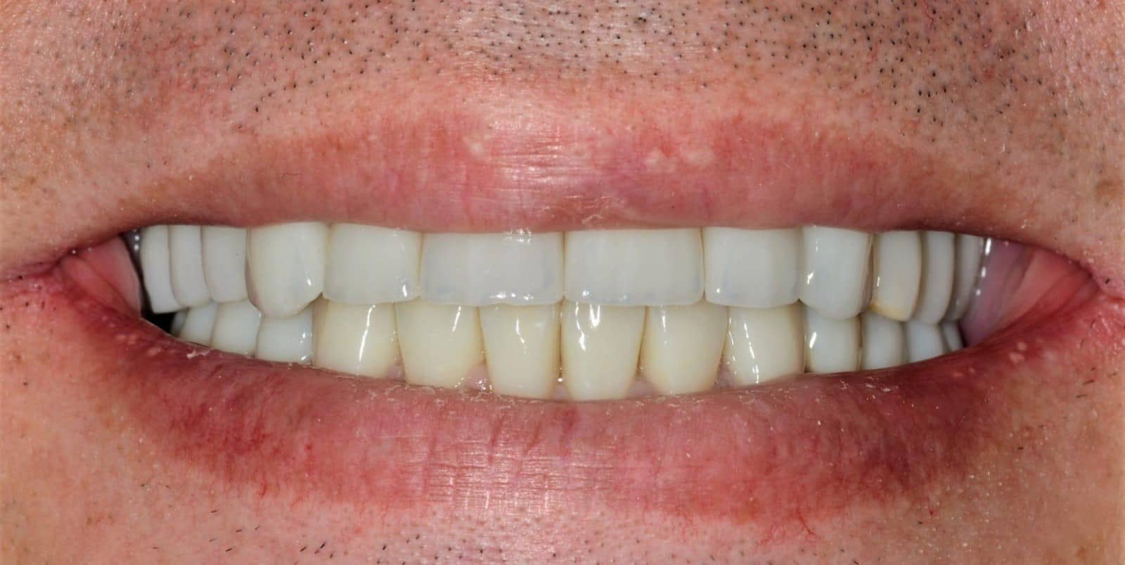 Cosmetic makeover case 3 after