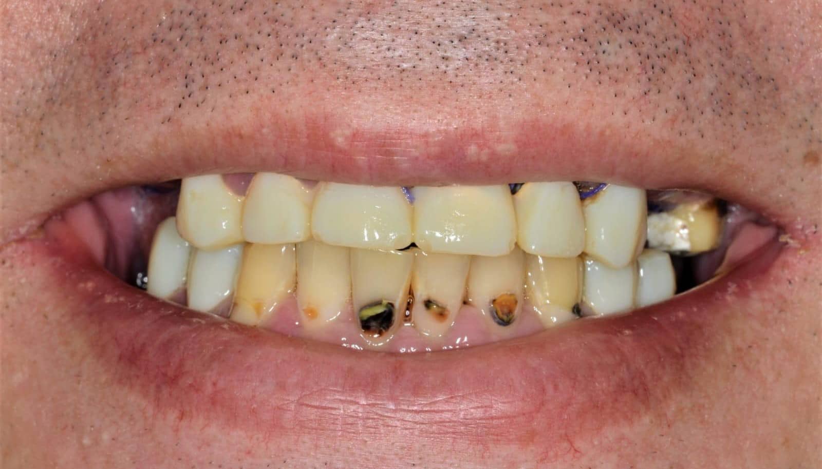 Cosmetic makeover case 3 before